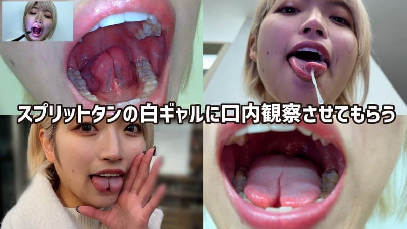 『街角で声をかけて口内観察させてもらう 美容部員 はるのちゃん』の代表画像