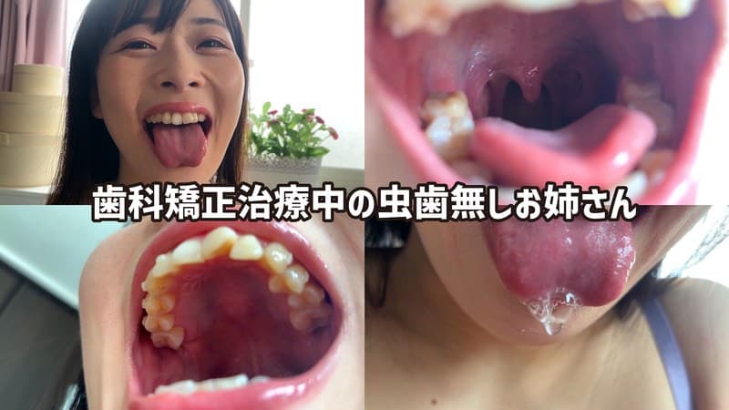『街角で声をかけて口内観察させてもらう ファーストフード店パート みおりさん』の代表画像