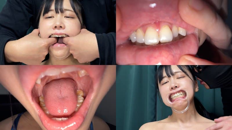 『よだれダラダラすずちゃんの口内観察』の代表画像
