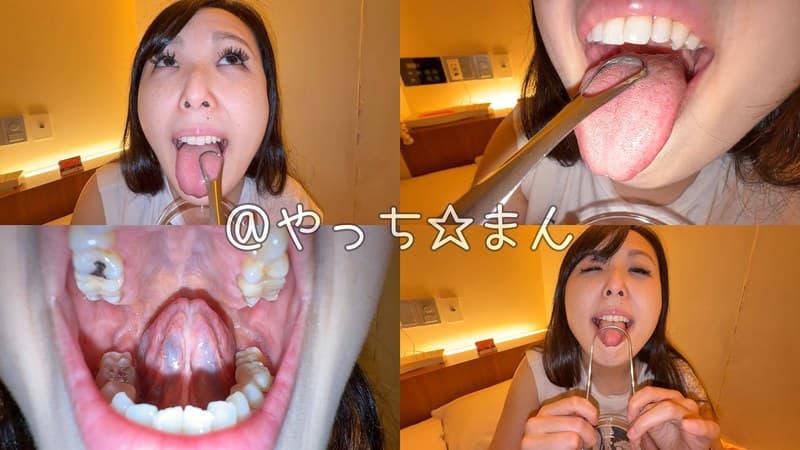 『【個人撮影】横山夏希の舌ブラシで「汚舌苔」採取』の代表画像